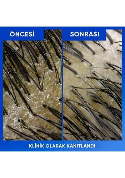 Head &amp Shoulders Arındırma Ve Parlaklık Kepeğe Karşı Etkili Şampuan 800ml