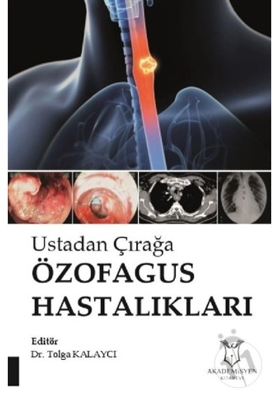 Ustadan Çırağa Özafagus Hastalıkları-Tolga Kalaycı
