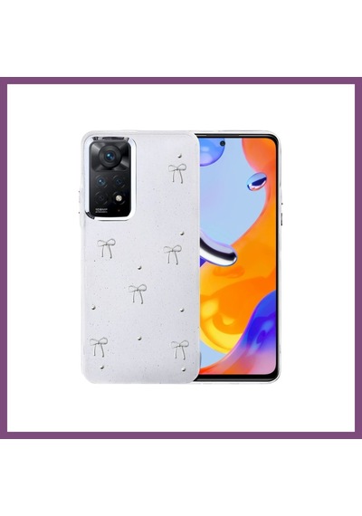 Twin Store Redmi Note 11 Pro Fiyonk Desenli Kapak - Desen 5 Bzstwın