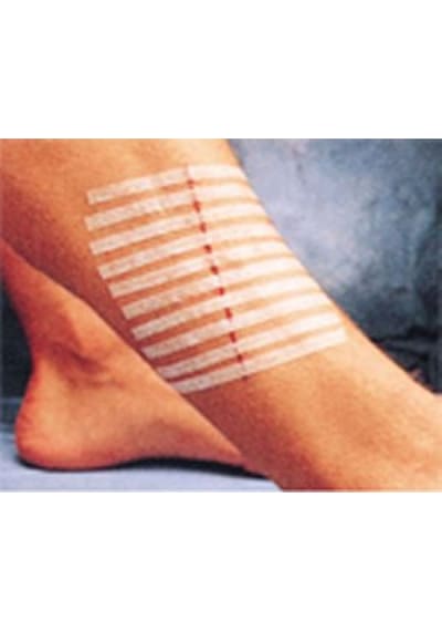 3M Steri-Strip R1546 Dikiş Bandı 6 x 100 MM 10 Adet