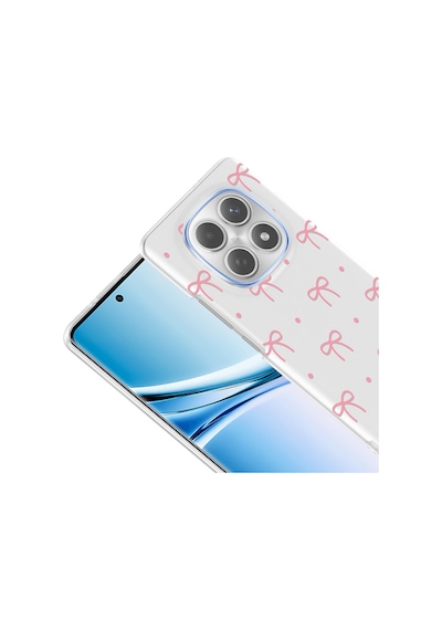 Xiaomi Redmi Note 15 5g Kılıf Çiçek Ve Fiyonk Desenli Kamera Yükseltili Cherena Premium
