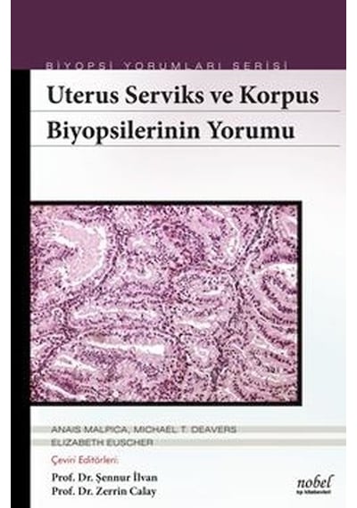 Biyopsilerin Yorumu: Uterus Serviks ve Korpus- Nobel Tıp Kitabevleri