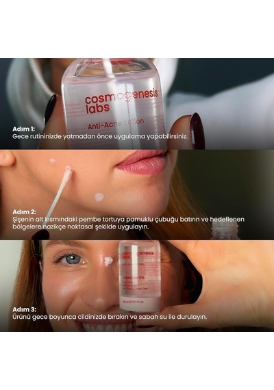 Akne Karşıtı Losyon 30 Ml Sku: Smg8690010414847
