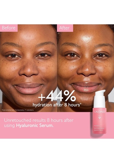 Vinohydra Hiyalüronik Serum 364796