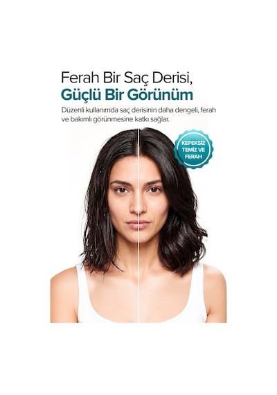 Scalpcare Saç Derisi Bakım Toniği 100 Ml