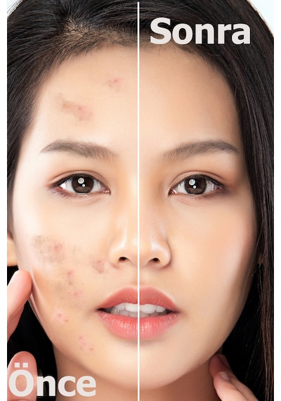 Devida Leke Karşıtı Aydınlatıcı Canlandırıcı Serum BrightFix Series A200 30 ML