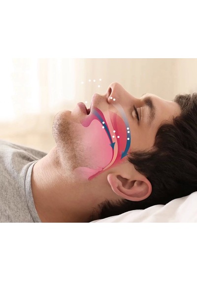 Zenvia Rahat Uyku İçin Anti Snore Sleep Horlama Engelleyici Aparat Uyku Stoperi Znv2026
