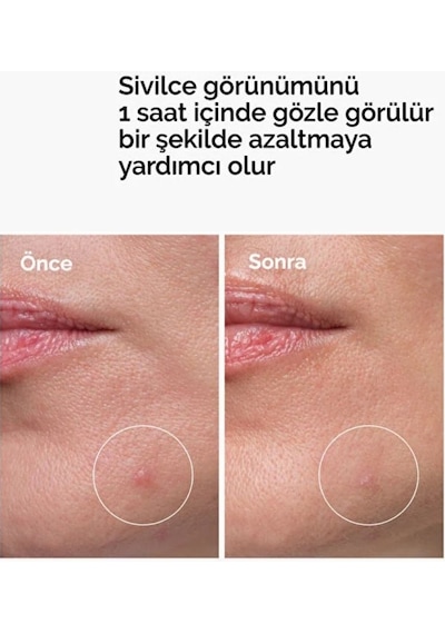 The Ordinary Sulfur 10% Powder-to-cream Concentrate