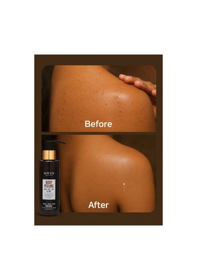 Arındır-onar Bakım Seti Aha Etkili Vücut Peelingi 150 Ml & Ayak Bakım Kremi 100 Ml