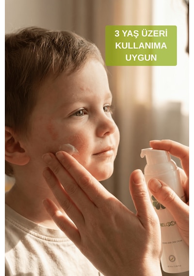Careloxon Atopik ve Egzema Eğilimli Ciltler İçin Cilt Bakım Kremi 100 ML