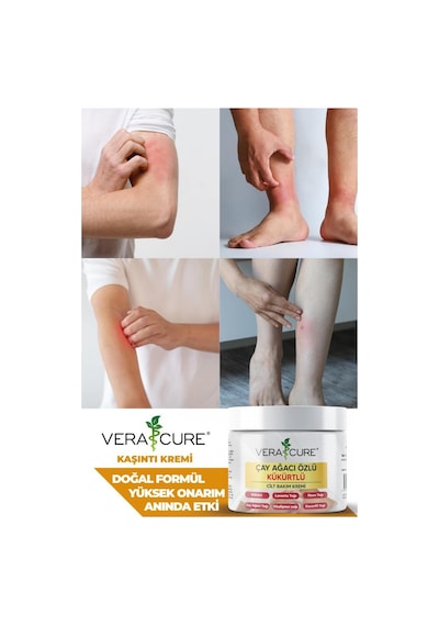 Vera Cure Çay Ağacı Özlü Kükürtlü Krem Eqzema, Ka.sinti, Sedf,