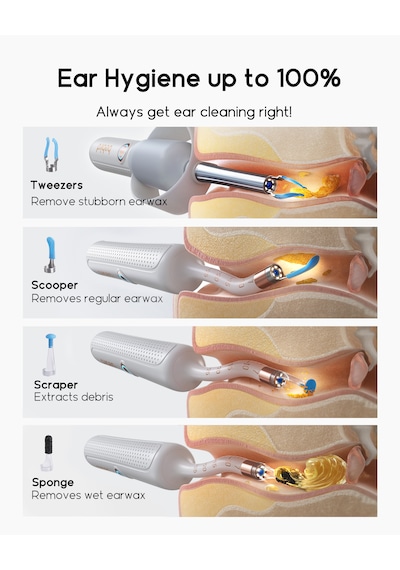 Bebird Earsight Plus Hd Kameralı Akıllı Görsel Kulak Temizleme Cihazı- Beyaz