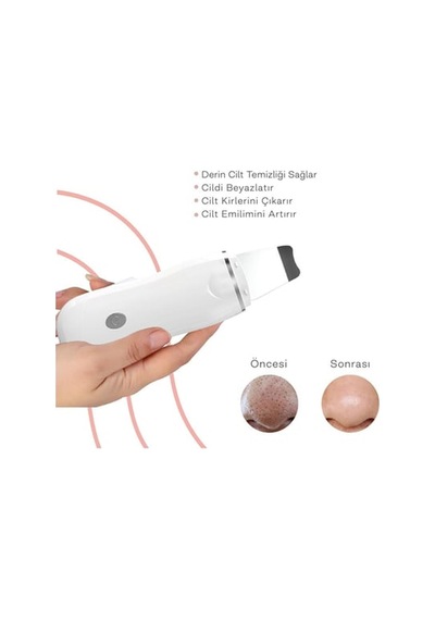 Ultrasonik Spatula Yüz Siyah Nokta Temizleme Çok Renkli