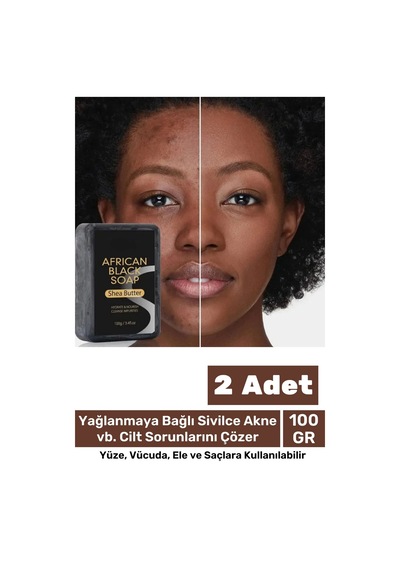 100% Doğal Güzel Kokulu El Yüz Saç Vücut Cilt Onaran Kolajen Etkili Afrika Bitkisel Sabun 2 Adet