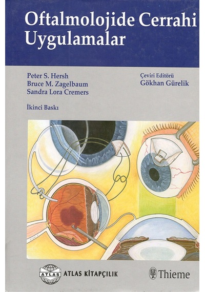 Oftalmolojide Cerrahi Uygulamalar