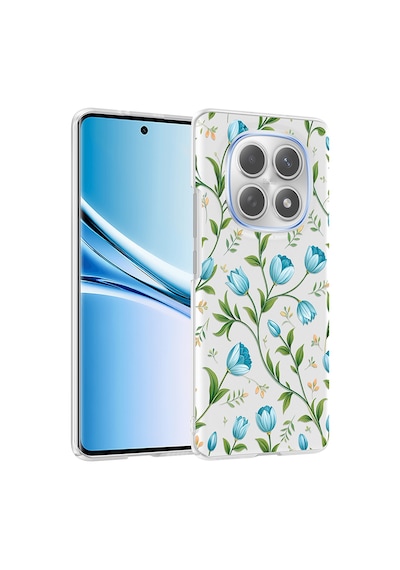 Teleplus Xiaomi Redmi Note 15 5g Kılıf Klipx Serisi Mat Desenli Tpu Kapak