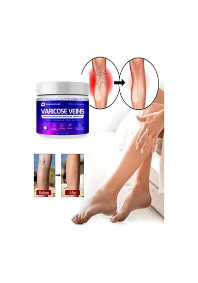 Maximum Strength Varicose Vein Var.is Bacak Bakım Masaj Kremi 100 Ml X 2 Adet