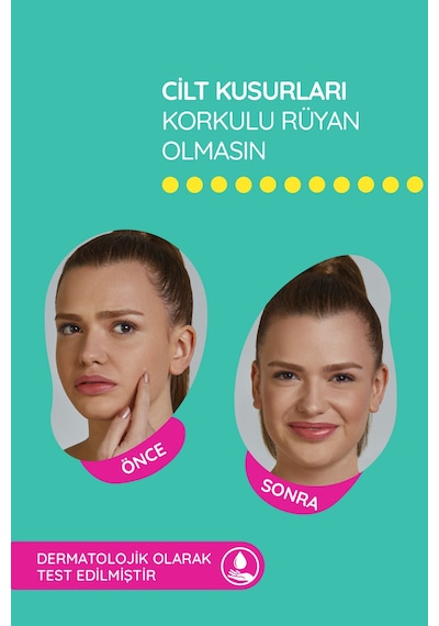 S.o.s Mixy 24 Lü Yüz Için Sivilce/akne Bandı 4 Boy Pimple Patch-hidrokolloid Bant