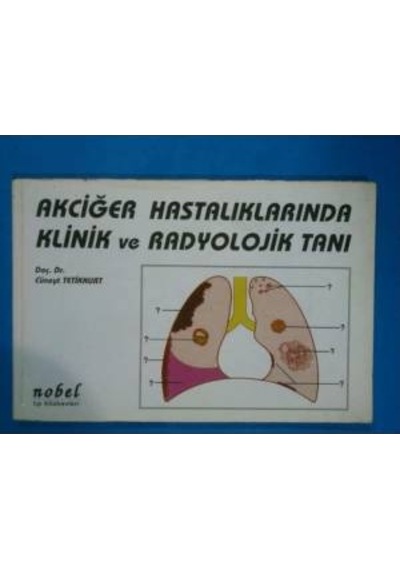 Akciğer Hastalıklarında Klinik Ve Radyolojik Ta