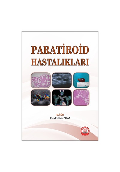 Paratiroid Hastalıkları- Ankara Nobel Tıp