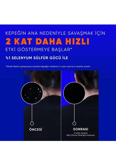 Clinical Strength Dry Scalp Rescue Kuru Saç Derisine Özel Şampuan 400 Ml X2 Adet