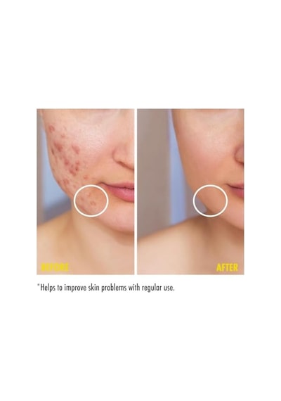 Maruderm Niacinamide%10 Leke Karşıtı Ve Gözenek Görünümü İnceltici Krem Düzensiz Cilt Tonu Ve Dokusuna Karşı Yoğun Etkili Bakım Kremi, 200 Ml