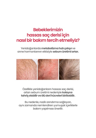 Bebeklere&yenidoğanlara Özel Konak Karşıtı Saç Derisi Losyonu Atopalm Newborn Scalp Lotion