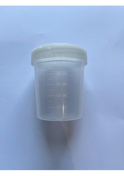 Non-steril İdrar Numune Kabı -100 Ml Mint