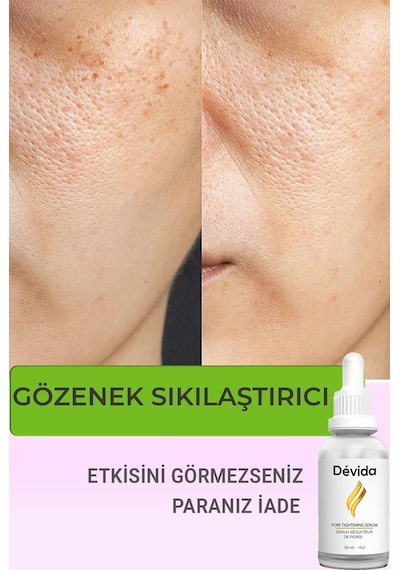 Devida Siyah Nokta Akne Gözenek Sıkılaştırıcı Vivo Series A210 30 ML