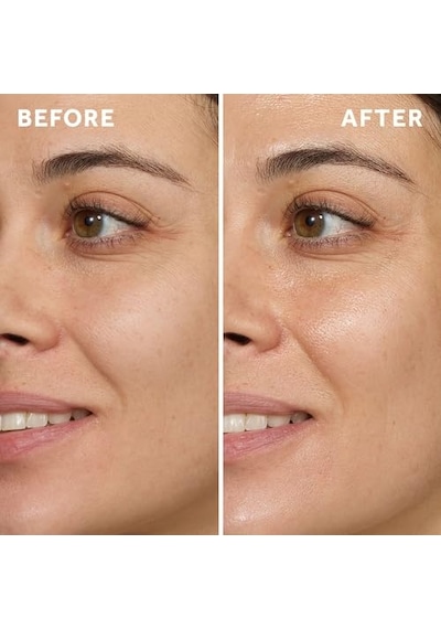Anti Blemish Booster Serum 30 Ml