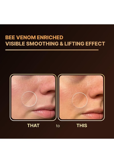 Tr Bee Venom Yüz Serumu 30 Ml - Hyalüronik Asit Ve Seramid İçeren Nemlendirici, Daha Pürüzsüz Ve Sıkı Görünü