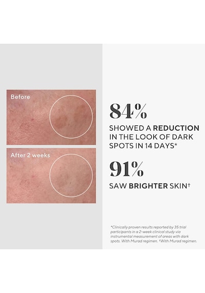 Murad  Rapid Dark Spot Correcting  Serum 30 ml