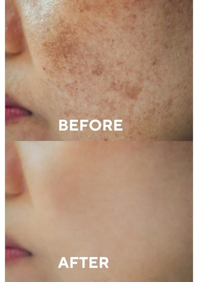 Leke Karşıtı Ve Cilt Tonu Eşitleyen Cilt Serumu, Glutatyon & Niacinamide Etkili 30 Ml