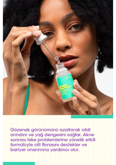 She Vec Hi Girls Bye Pores Akne ve Leke Karşıtı Bakım Serumu 30 ML
