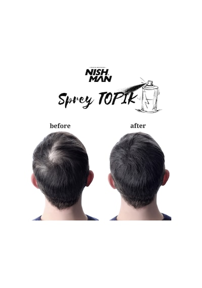 Nish Man Saç Dolgunlaştırıcı ve Seyrek Kapatıcı Root Touch Up Sprey 100 ML