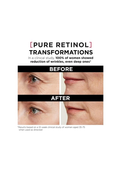 Tr 'l'oreal Paris Revitalift Triple Power Lzr Retinol Gece Serumu Yüz İçin,%0,3 Saf Retinol İçeren, Cildi Nemlendiri