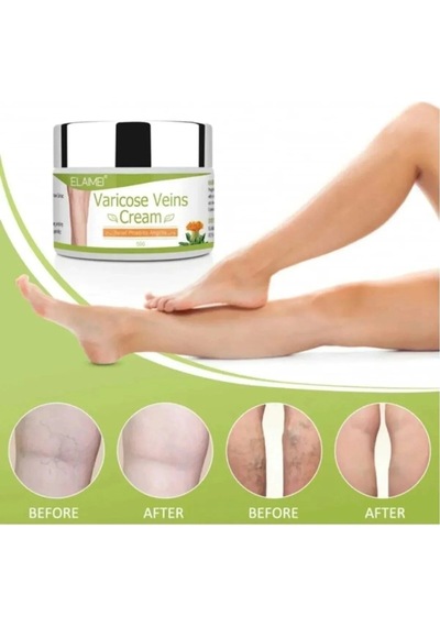 Varicose Kremi 100 Ml