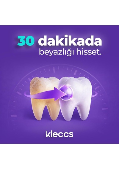 Diş Beyazlatma Bandı, Hızlı Beyazlık, 14 Paket-28 Bant, Hızlı Diş Beyazlatma Bandı, Günlük Ve Bireysel Kullanıma Uygun
