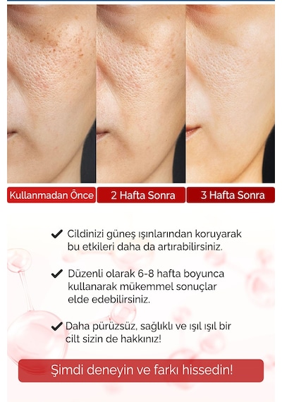 Devida Dolgunlaştırıcı Etkili Göz Çevresi ve Kaz Ayağı İçin Kolajen Vega Series A230 30 ML