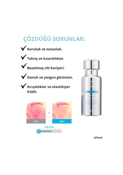 Apothe Exosome Squal-tox 3% Ampoule 30 Ml %3 Ekzosom Ve Skualen İçeren Ampul Konsantresi