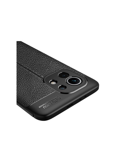 Xiaomi Mi 11 Kılıf Niss Deri Görünümlü Silikon Kapak