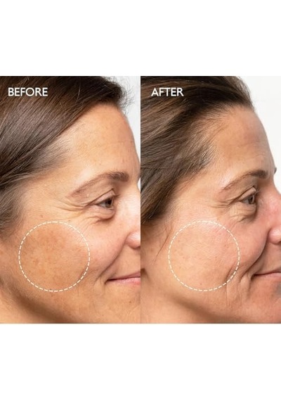 Beyazlatıcı Etkili Leke Karşıtı Bakım Kremi Arbutin Yüzde İki Brightening Krem 50ml
