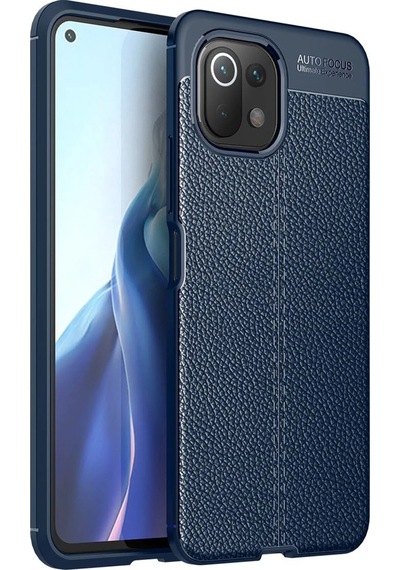 Cosmotex Newface Xiaomi Mi 11 Lite Kılıf Auto Focus Kapak - Lacivert