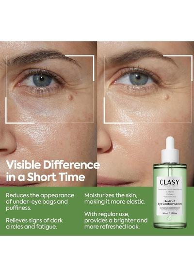 Clasycare Radiant Göz Çevresi Serumu Kafein Göz Serumu Hyaluronik Asit Ve C Vitamini İle Göz Altı Morluklar