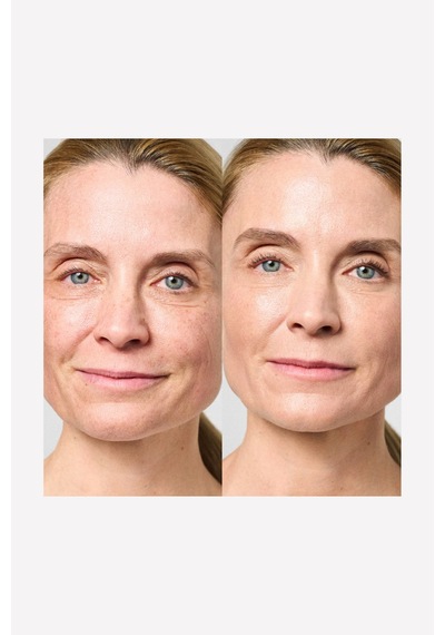 Aqua Intense 120 Saat Etkili Yoğun Nemlendirici Hyaluronlu Parfümsüz Yüz Kremi