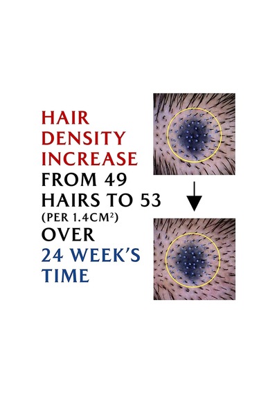 Dermatical Hair-loss Saç Dökülmesine Karşı Şampuan 200ml Kuru