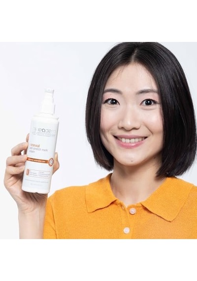 Renewal Anti Stretch Mark Krem 200 Ml