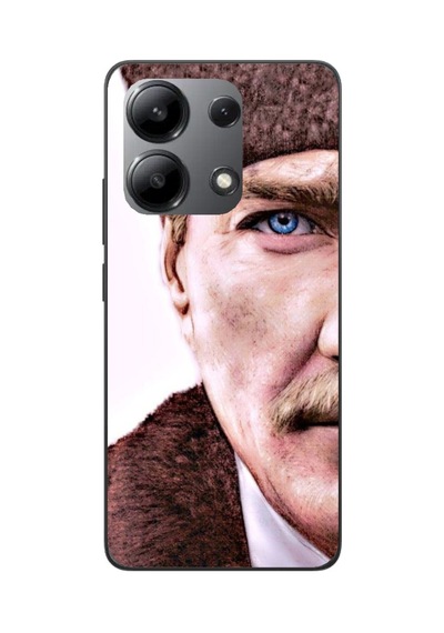 Xiaomi Redmi Note 13 Pro 4g Kamera Korumalı Baskılı Desenli Özel Seri Kılıf Kapak Renk2 Renk2