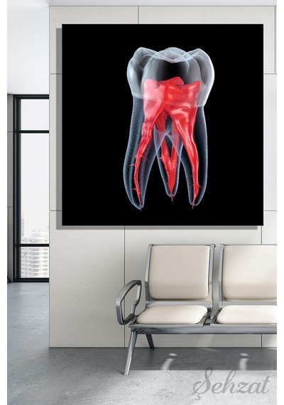Kare Kanvas Duvar Tablosu Tekli Ağız Diş Sağlığı Dişçi Dental Kök Anatomisi Endodonti Çok Renkli