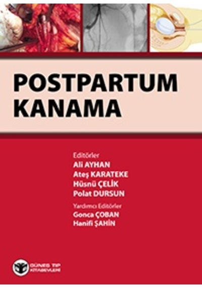 Postpartum Kanama